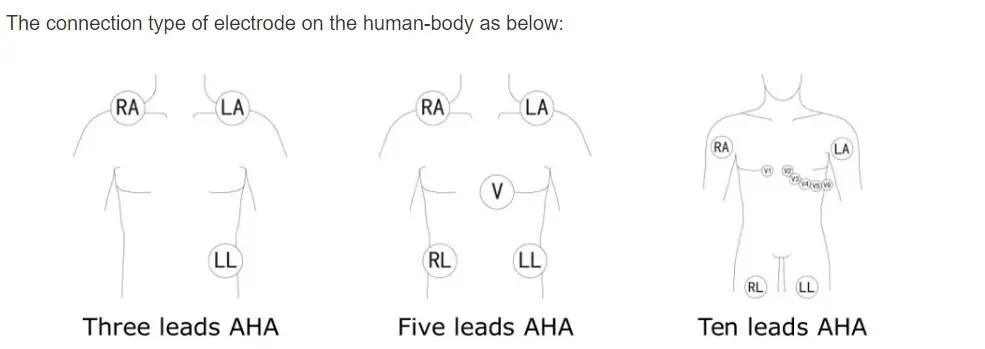5-vodni EKG vodniki za philips digitrak plus 24 urni holter 3100A, 5-vodni, Snap
